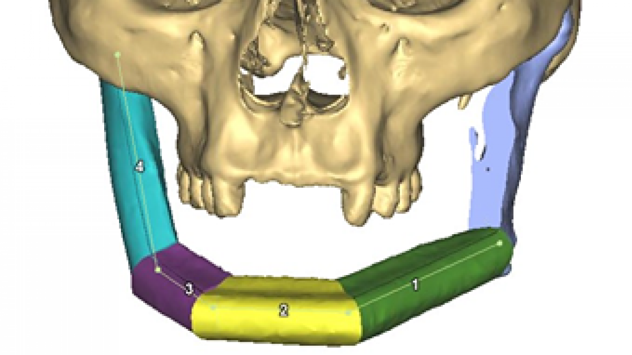 Microvascular reconstruction outcomes from a New Zealand Oral and Maxillofacial Surgery Unit